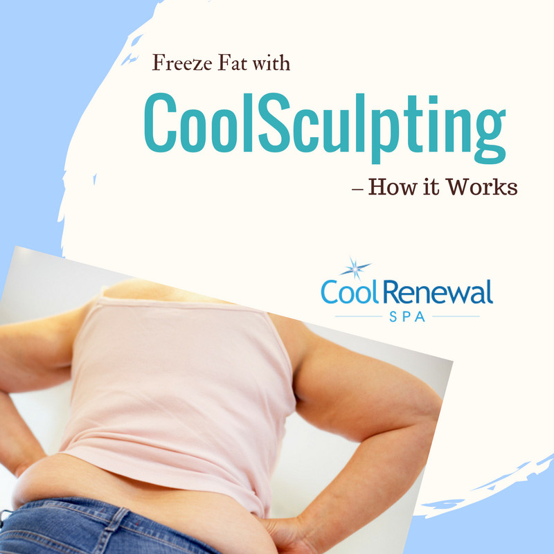 Freeze Fat with CoolSculpting How it Works Cool Renewal Spa