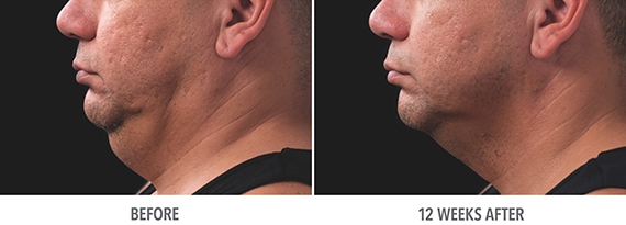 Male_Patient_5_small