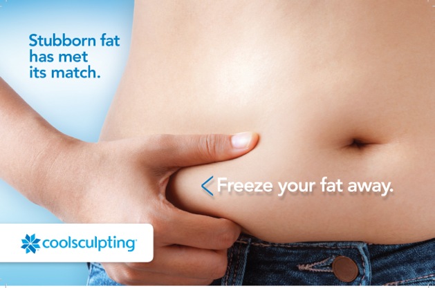 CoolSculpting Services in Pineville, North Carolina