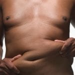 Liposuction Alternative in Pineville, North Carolina