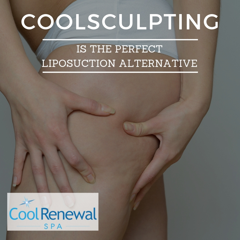 CoolSculpting is the Perfect Liposuction Alternative