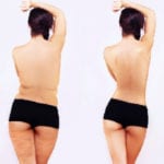 Fat Loss in Charlotte, North Carolina