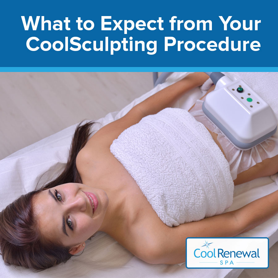 What to Expect from Your CoolSculpting Procedure