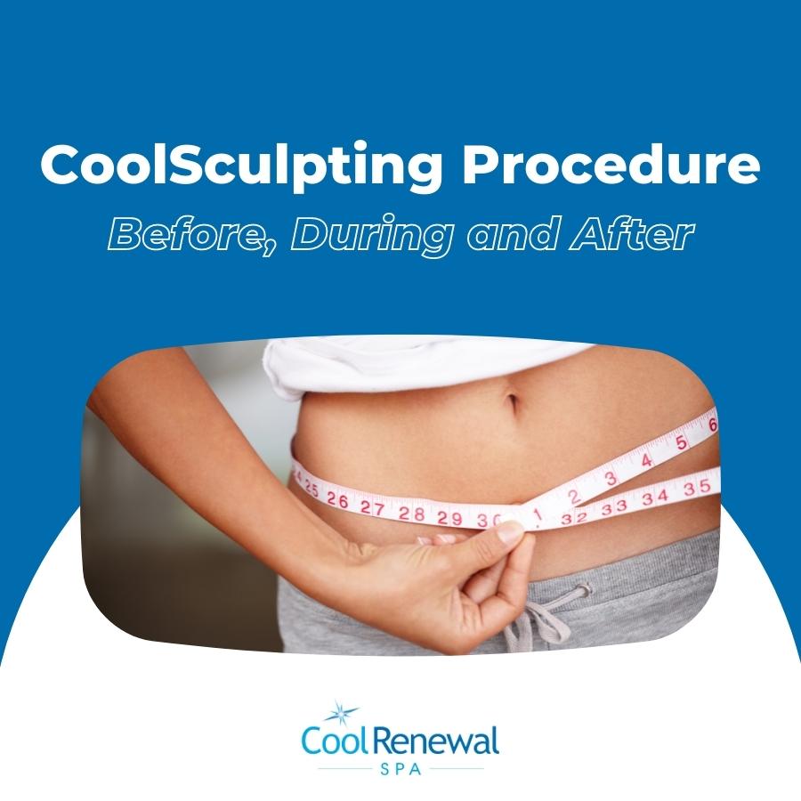 Coolsculpting Procedure Before During And After Cool Renewal Spa