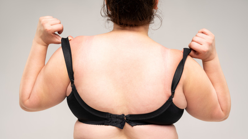 Are Fat Removal Treatments Right for You?