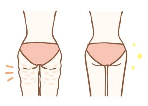 The Amazing Benefits of CoolSculpting