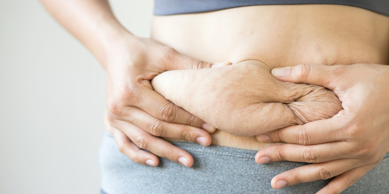 Your Guide to Body Sculpting Consultations: What to Expect 