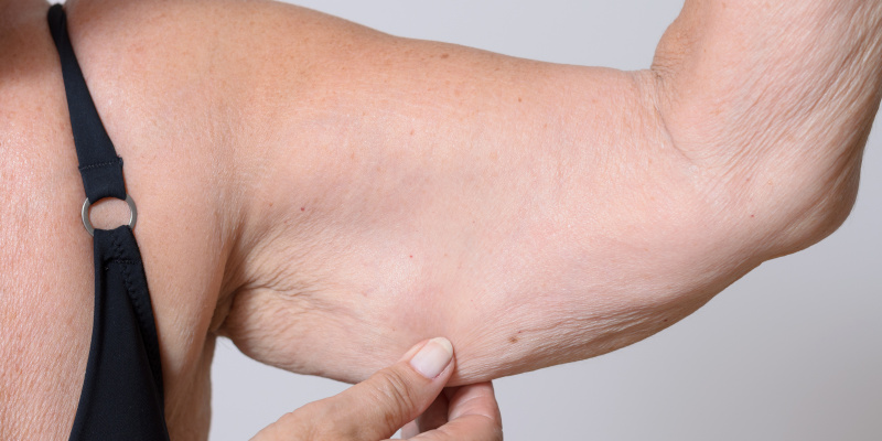 Why Fat Loss Matters: Unveiling the Truth with CoolSculpting 